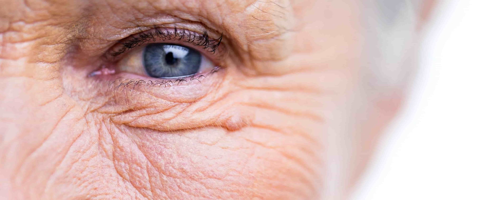 What Are the Risks of Bending Over After Cataract Surgery?