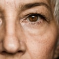 Everything You Need to Know About Cataract Surgery