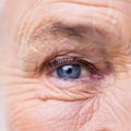 What Are the Risks of Bending Over After Cataract Surgery?