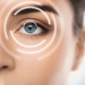 Cataract Surgery: How Long Does It Last and What to Expect
