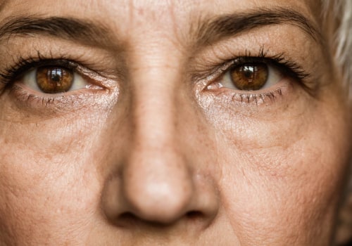Everything You Need to Know About Cataract Surgery