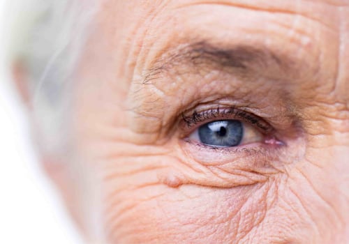 What Are the Risks of Bending Over After Cataract Surgery?